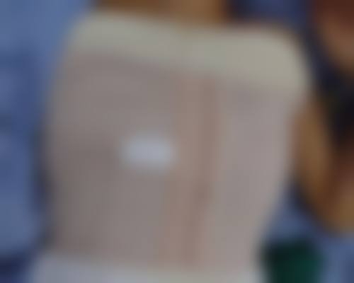 六、刀疤疤痕修复与生活习惯的关系