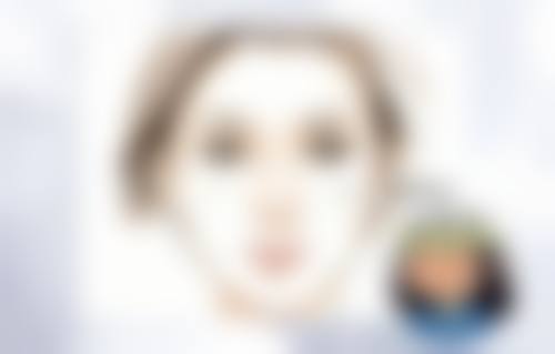 七、单眼皮变双眼皮的相关情况