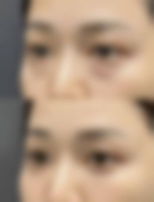 五、玉林市前列人民医院价格表