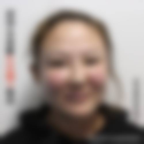 八、襄阳米拉德医疗美容门诊部真实的患者评价