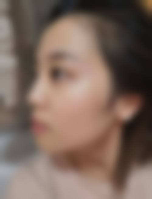 三、襄阳米拉德医疗美容门诊部诊疗项目有哪些？