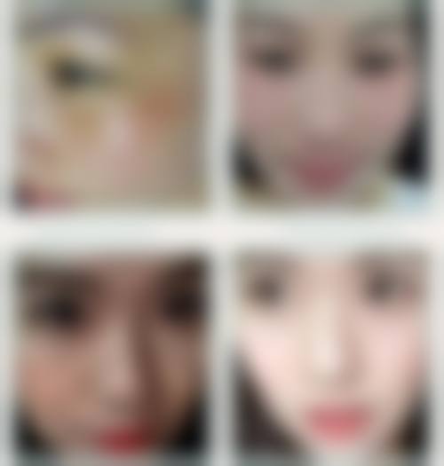 六、郑州和之美医疗美容诊所价格表