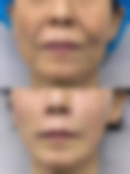 二、温州鹿城韩星整形医疗美容医院怎么样？