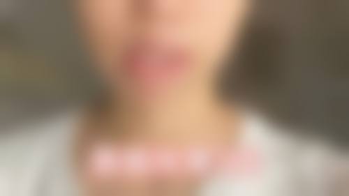 九、浙江省中医院整形美容中 心真实的患者评价