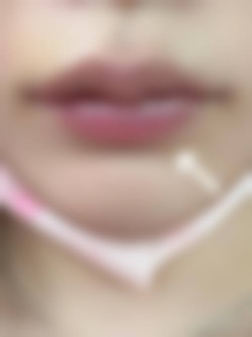 四、浙江省中医院整形美容中 心特色项目