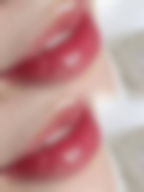 五、浙江杭州智美颜和医疗美容诊所价格表