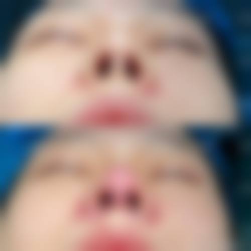 二、浙江省中医院整形美容中 心怎么样?