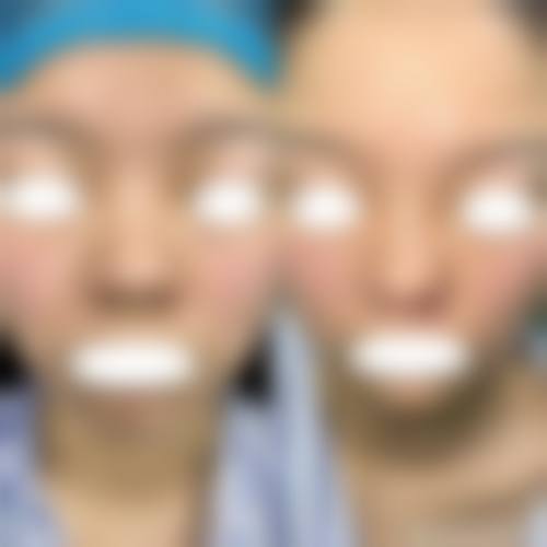 六、浙江省中医院整形美容中 心价格表