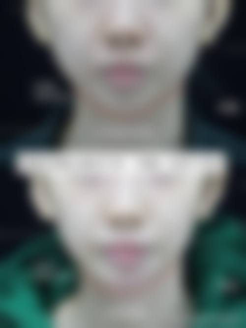 九、重庆亚美蜜园医疗美容门诊部真实的患者评价