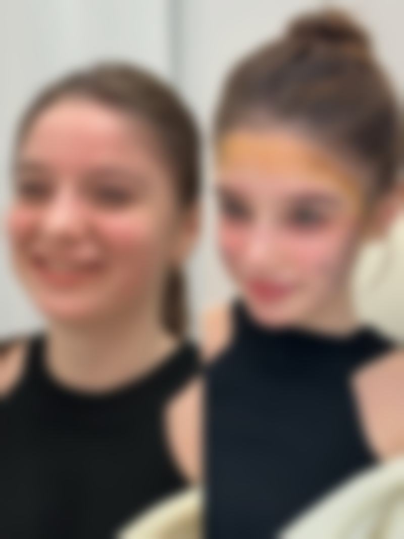 二、瘦脸针多久可以出成效