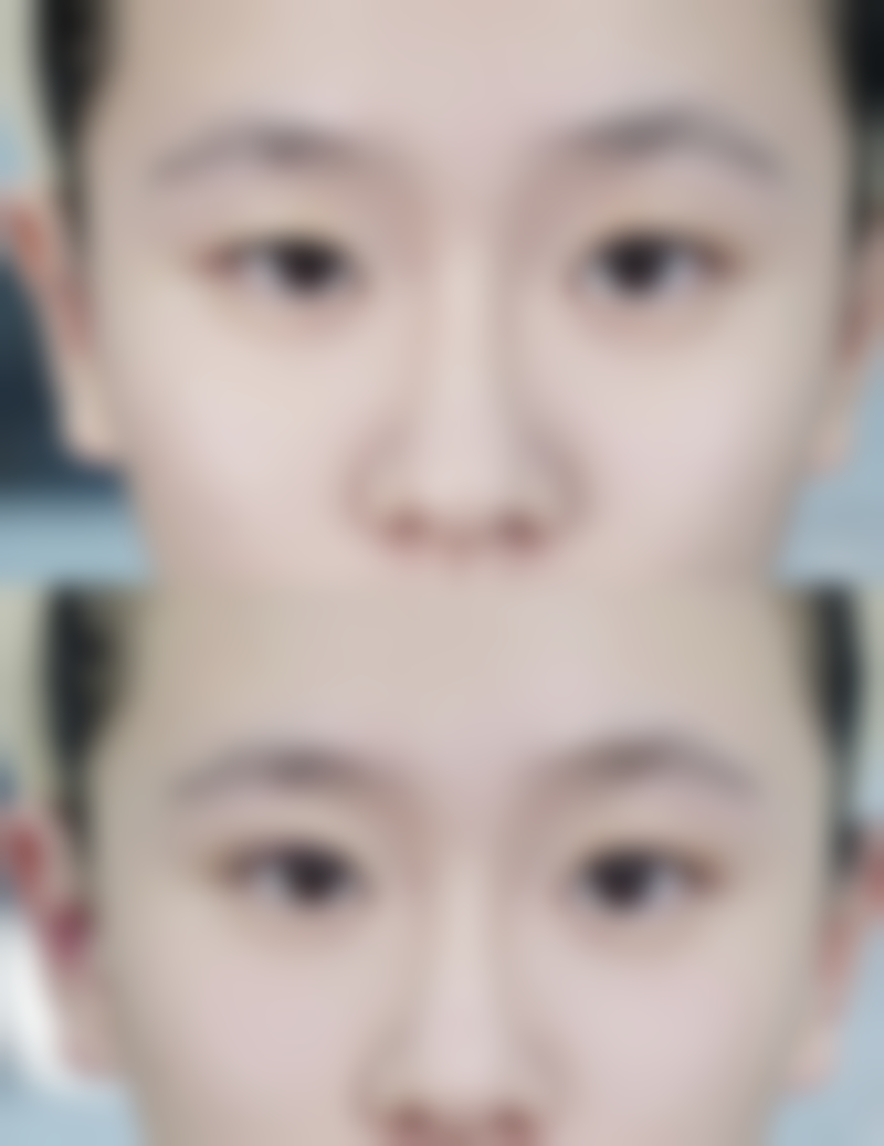 {怎么知道自己是双眼皮还是单眼皮？教你从多方面精准辨别眼部特征