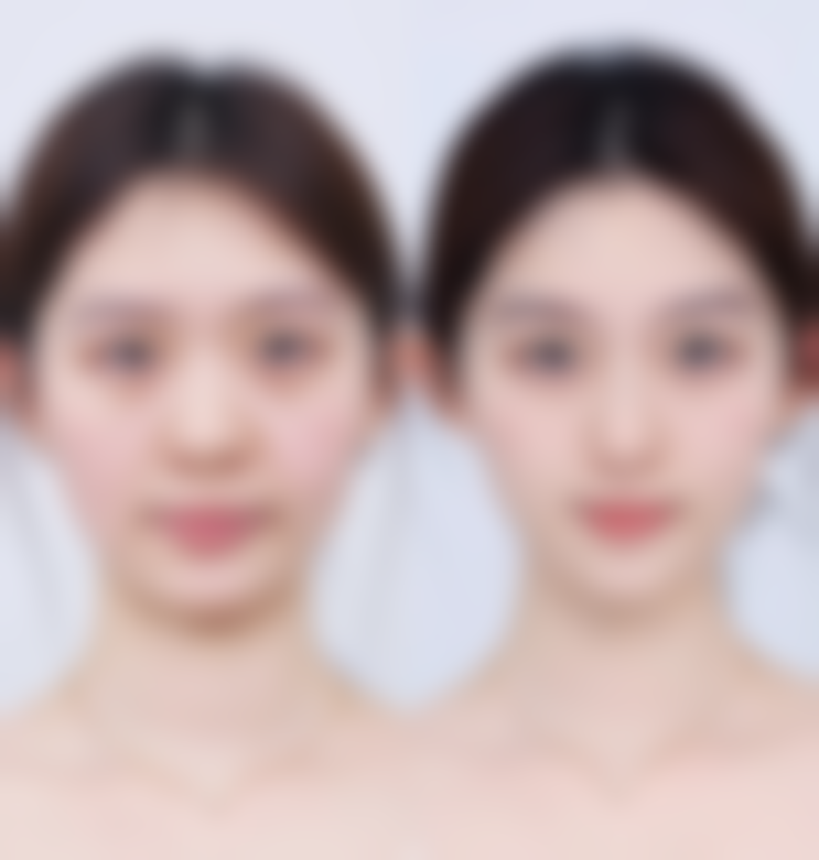 九、甘肃美联伊美医疗美容门诊部真实的患者评价