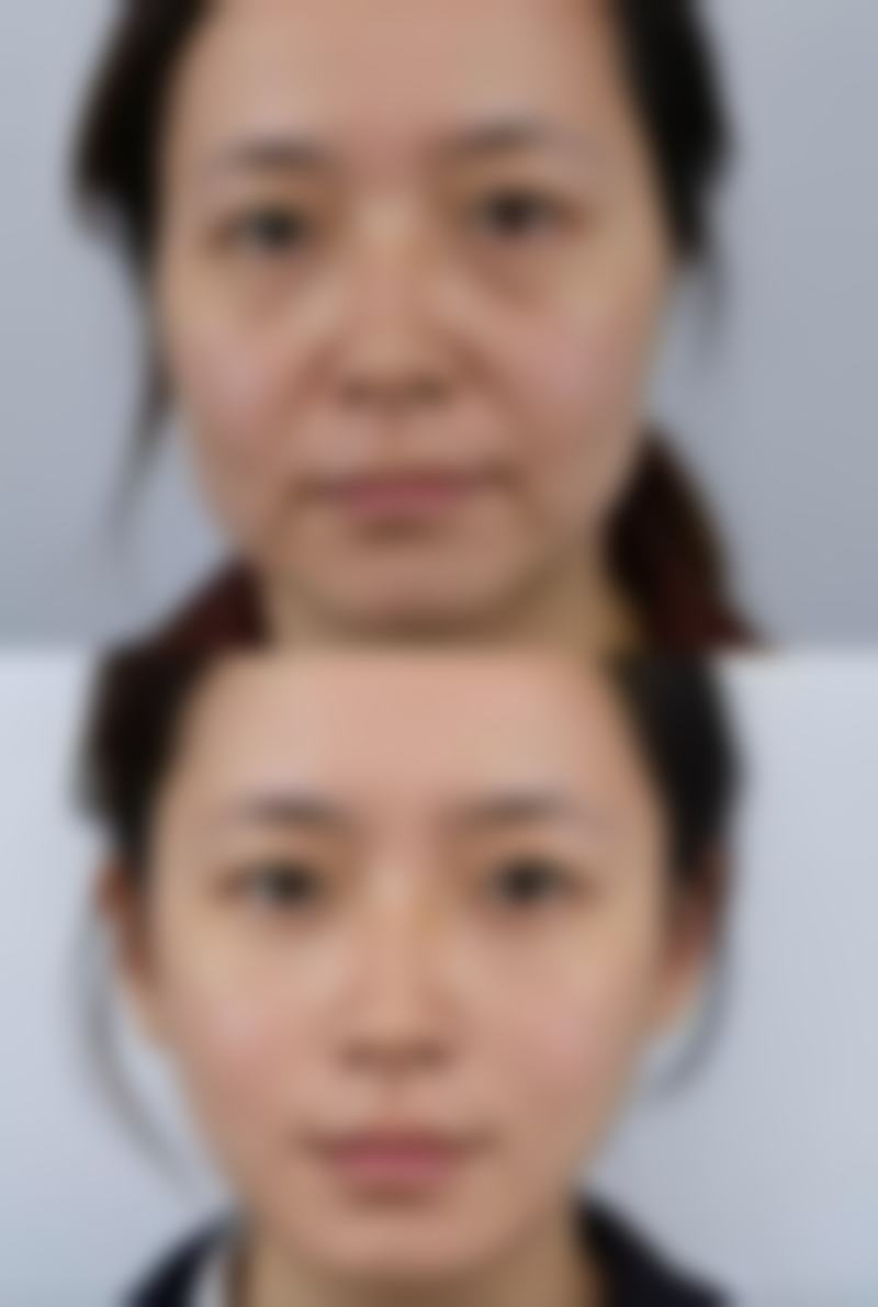 四、温州鹿城韩星整形医疗美容医院特色项目