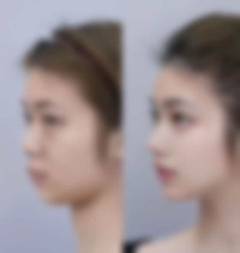 四、历下珍华医疗美容诊所特色项目