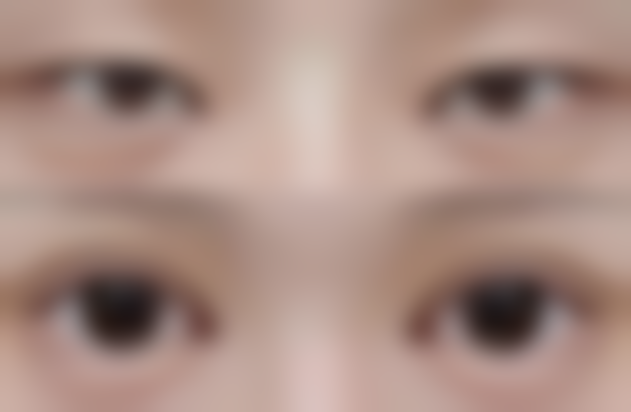 三、通过观察不同状态下的眼部情况判断怎么知道自己是双眼皮