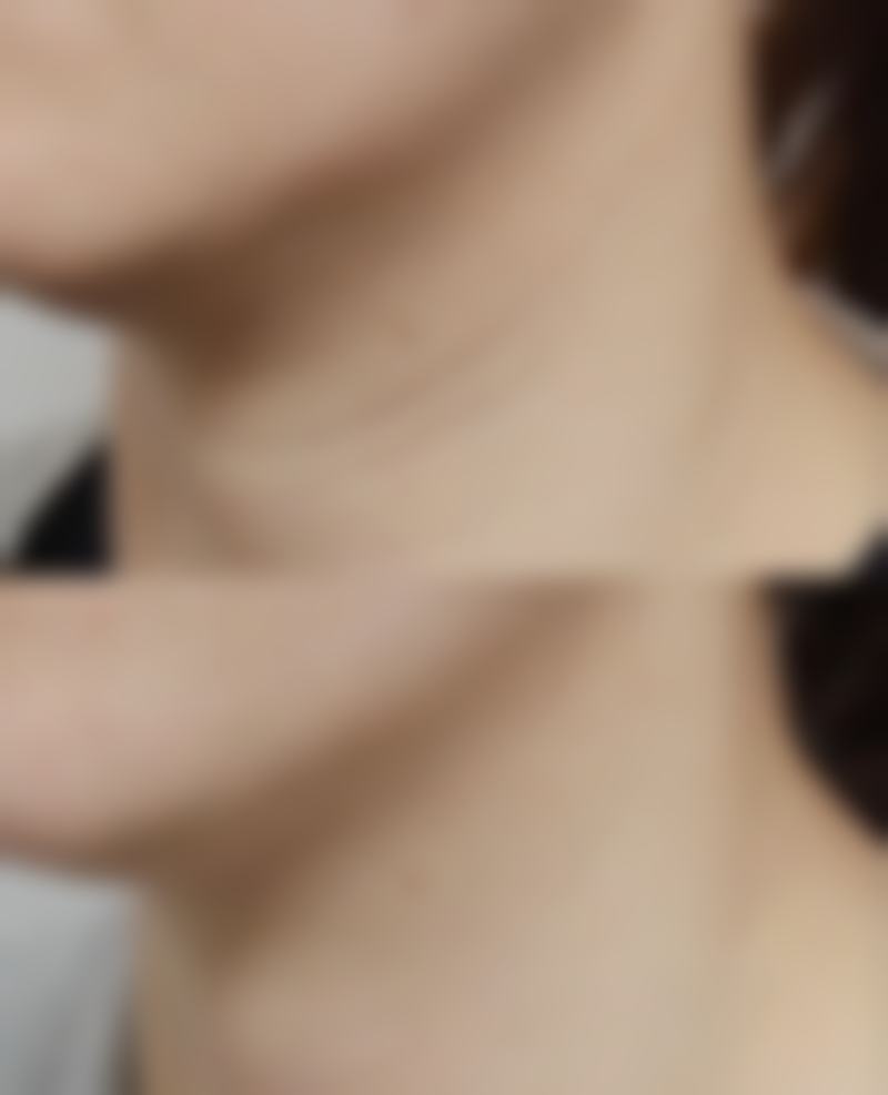 三、杭州艾玛医疗美容诊疗项目有哪些？