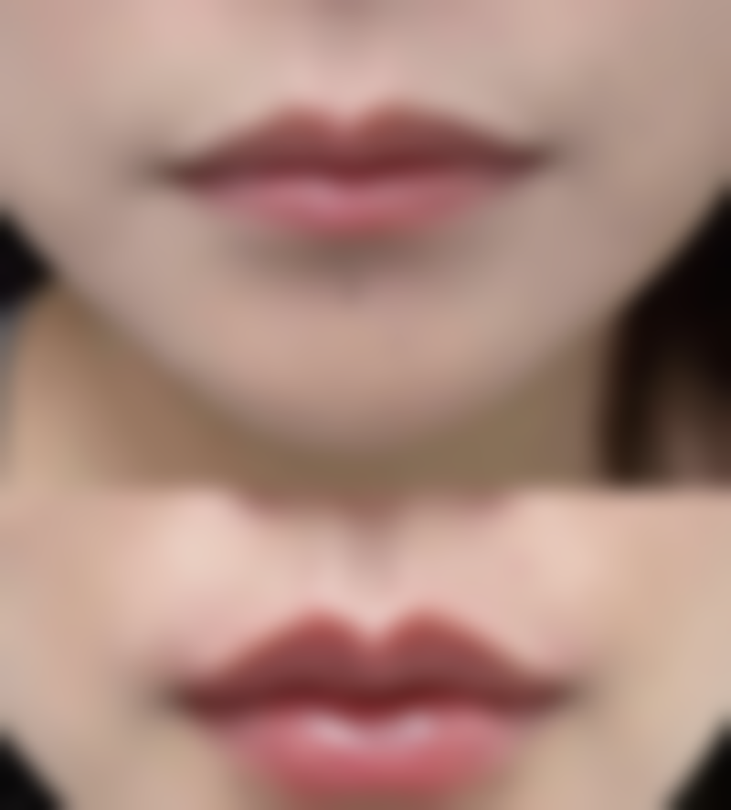 六、考虑特殊情况判断怎么知道自己是双眼皮