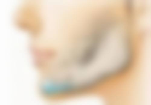 五、日常护理方法