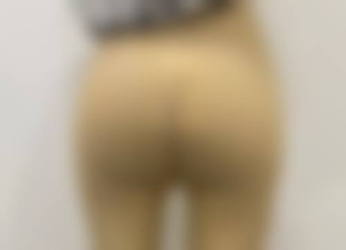 二、眼袋和眼睑是一个部位吗