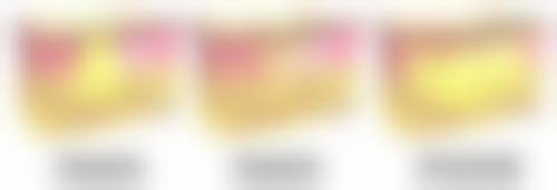 二、术后看手机有无禁忌？小心用眼保修复