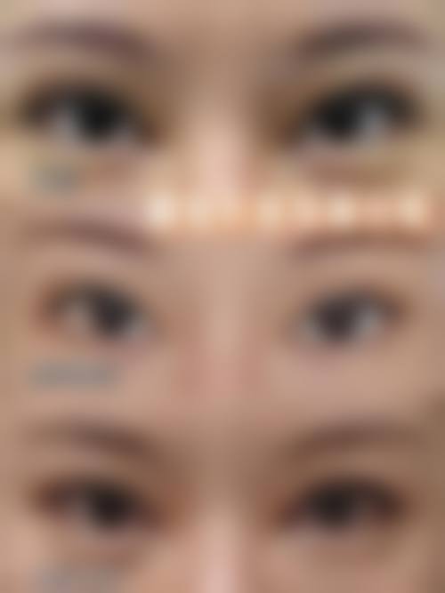 八、广州轻伊美皮肤专科门诊部真实的患者评价