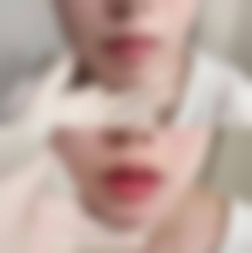 二、长春南关区圣颜医疗美容门诊部怎么样？