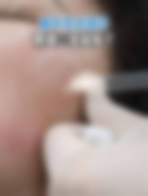 八、成都华生铂悦医疗美容整形门诊部真实的患者评价