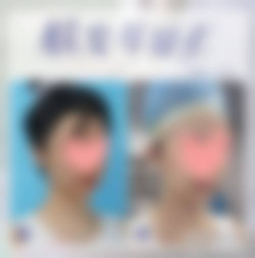 九、沧州市中 心医院医学整形美中 心真实的患者评价