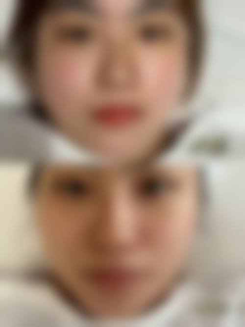 九、重庆阳光医院整形美容科真实的患者评价