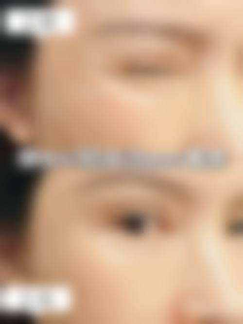 九、武汉市美之术医疗美容诊所真实的患者评价