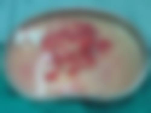 六、国内人民解放军第四五八医院皮肤美容中 心地址及交通