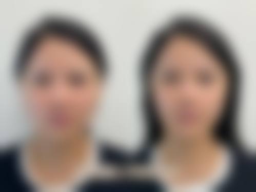 五、品川美容外科 上野院价格表