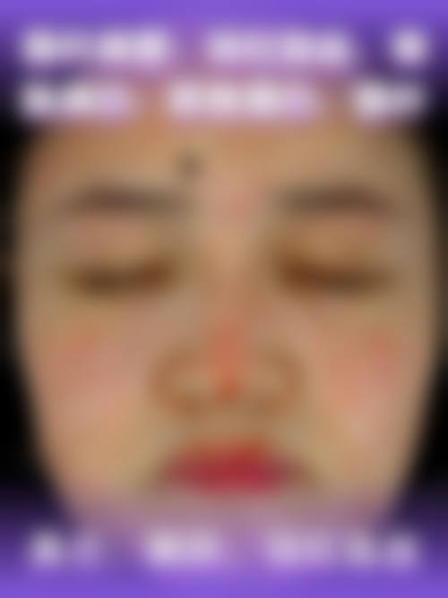 四、成都熙施婉美医疗美容诊所特色项目