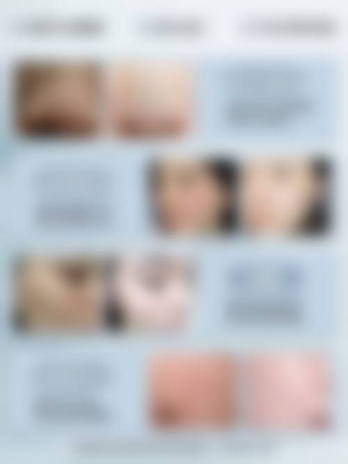 二、广州轻伊美皮肤专科门诊部怎么样？