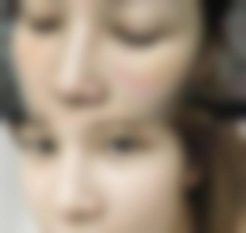 八、义乌德尔美客医疗美容真实的患者评价