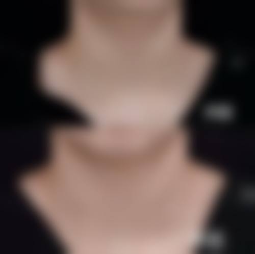 五、国内人民解放军第四五八医院皮肤美容中 心价格表