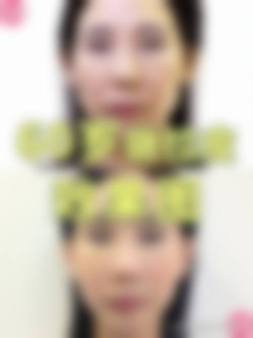 四、武汉市美之术医疗美容诊所特色项目