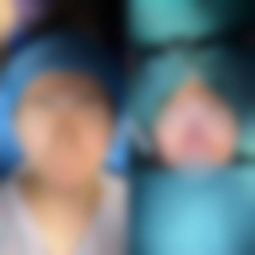 八、枣庄铭美医学美容真实的患者评价