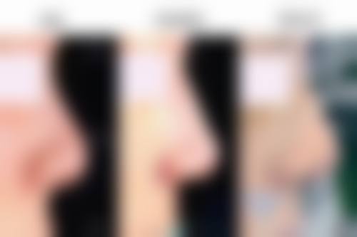 五、成都华生铂悦医疗美容整形门诊部价格表