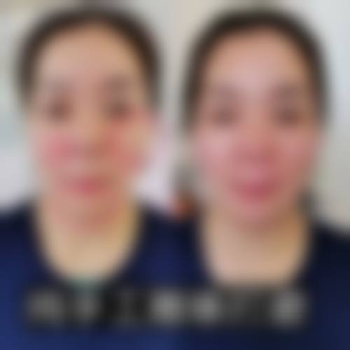八、合肥台美医疗美容门诊部真实的患者评价
