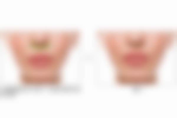 九、北京蕾士悦容医疗美容门诊部真实的患者评价