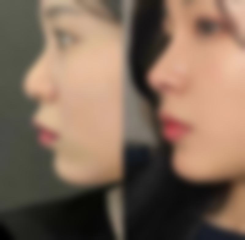 五、刘思思怎么预约？