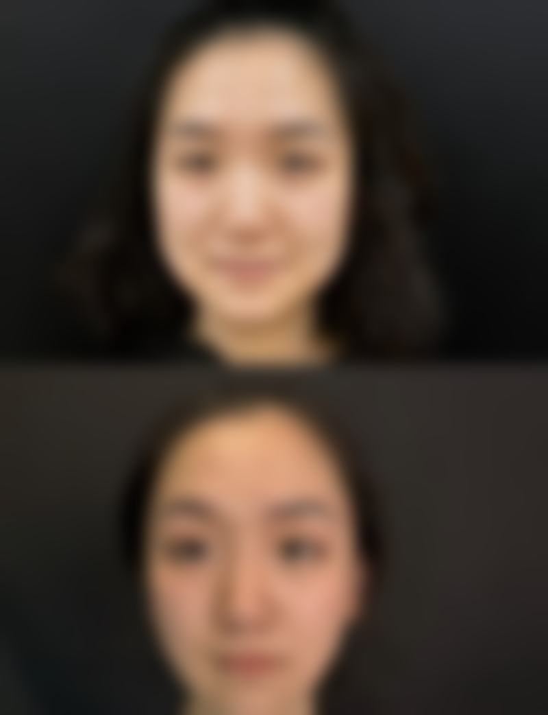 三、广州轻伊美皮肤专科门诊部诊疗项目有哪些？