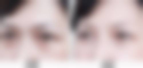 二、合肥壹美尚整形医院怎么样？