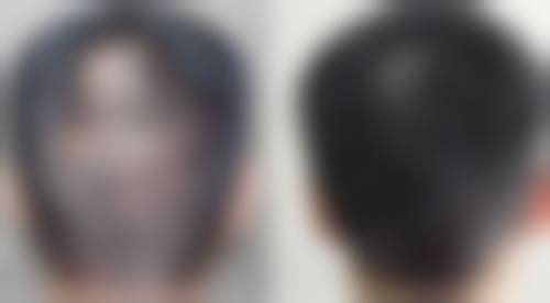 九、西安市第九医院烧伤整形门诊部真实的患者评价