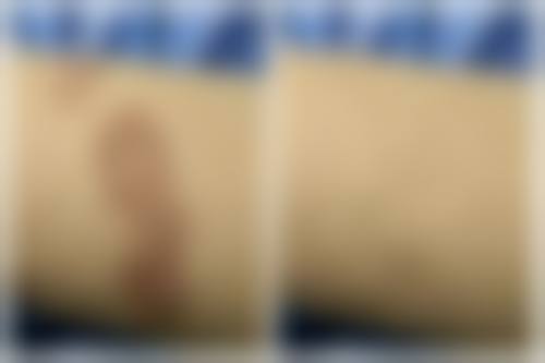 二、宁波美莱整形医院怎么样?