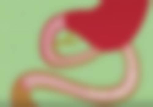 六、拆埋线双眼皮的注意事项