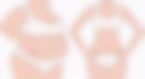 四、做双眼皮手术修复期间的美学与风险提示