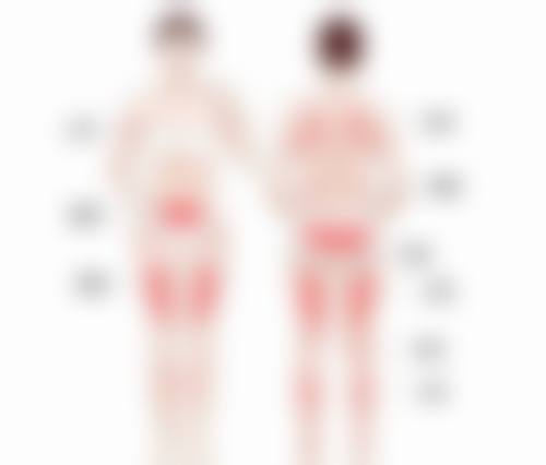 {怎么样去烫伤的疤痕最有效？分层修复、联合治疗助你告别烫伤疤痕困扰！ 