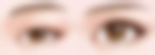 二、做双眼皮手术的修复阶段及护理要点